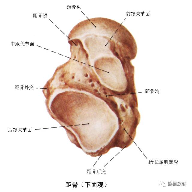 踝关节系统解剖图+冠/矢/轴MRI 踝关节系统解剖图+冠/矢/轴MRI