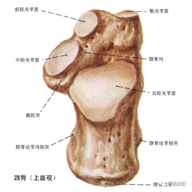 踝关节系统解剖图+冠/矢/轴MRI 踝关节系统解剖图+冠/矢/轴MRI