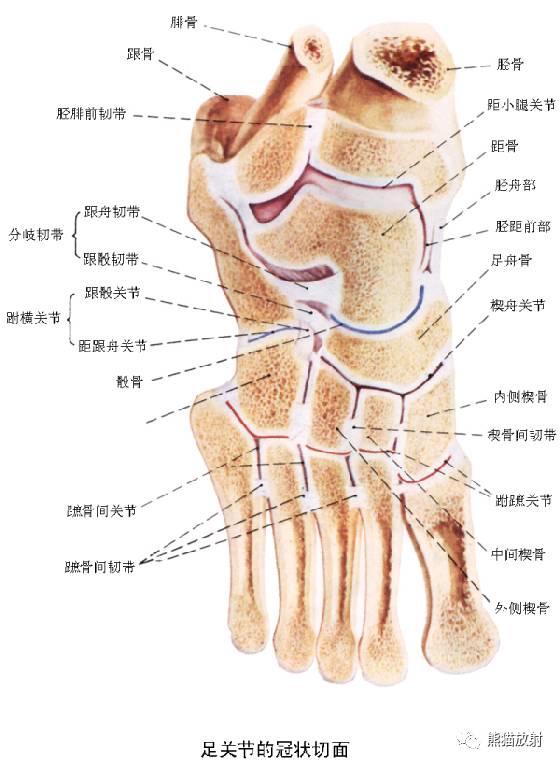 踝关节系统解剖图+冠/矢/轴MRI 踝关节系统解剖图+冠/矢/轴MRI