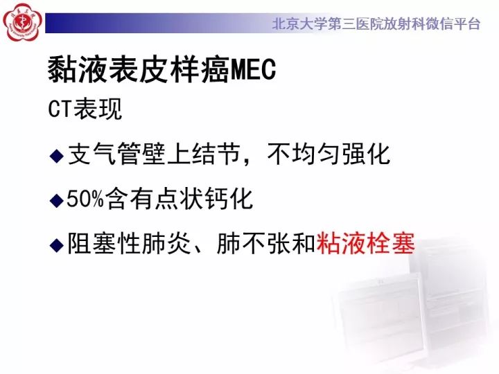 【病例】气管肿瘤1例CT影像诊断