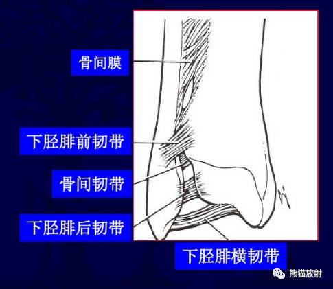 踝关节韧带解剖及损伤 踝关节韧带解剖及损伤