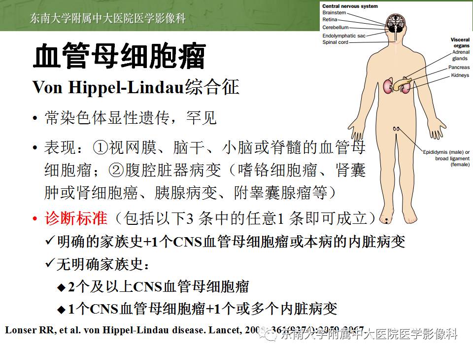 【病例】成人小脑肿瘤2例MR影像诊断