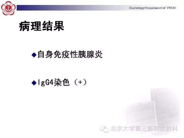 【病例】自身免疫性胰腺炎1例CT及MR影像诊断
