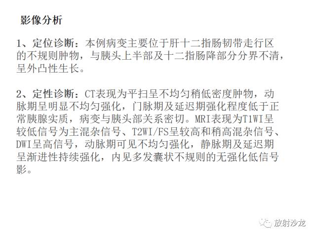 【病例】胰腺神经内分泌肿瘤1例