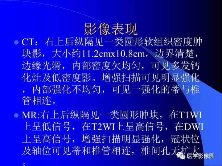 【病例】后纵隔神经鞘瘤1例CT及MR影像表现