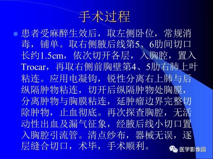 【病例】后纵隔神经鞘瘤1例CT及MR影像表现