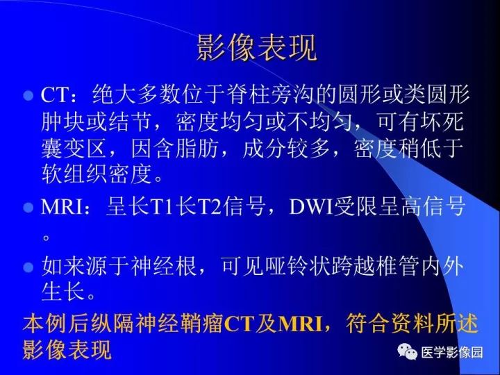 【病例】后纵隔神经鞘瘤1例CT及MR影像表现