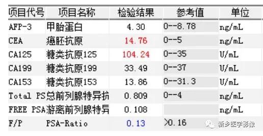 【病例】左侧肱骨软骨肉瘤1例X线CT影像表现 【病例】左侧肱骨软骨肉瘤1例X线CT影像表现