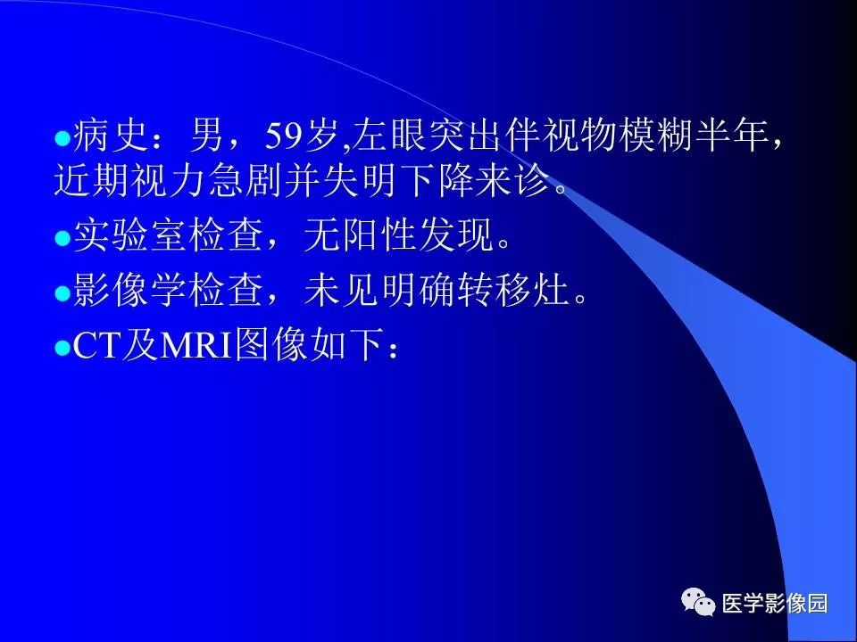 【病例】左眼黑色素瘤1例CT及MR影像表现