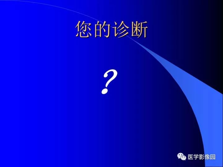 【病例】左眼黑色素瘤1例CT及MR影像表现