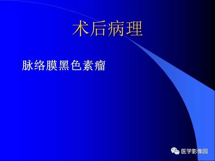 【病例】左眼黑色素瘤1例CT及MR影像表现