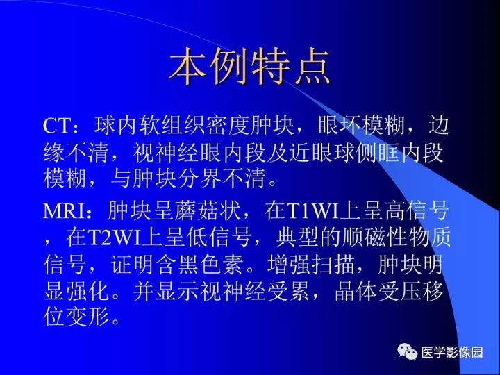 【病例】左眼黑色素瘤1例CT及MR影像表现