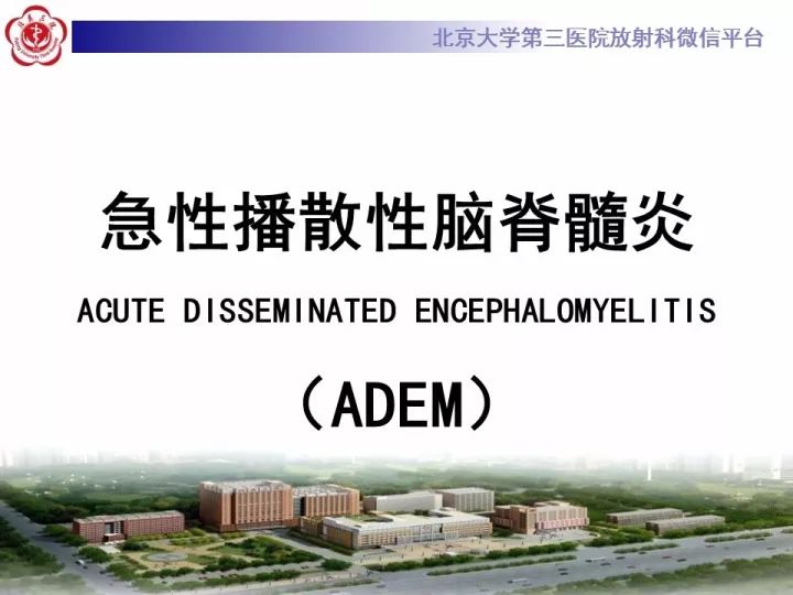 【病例】急性播散型脑脊髓炎1例MR影像诊断