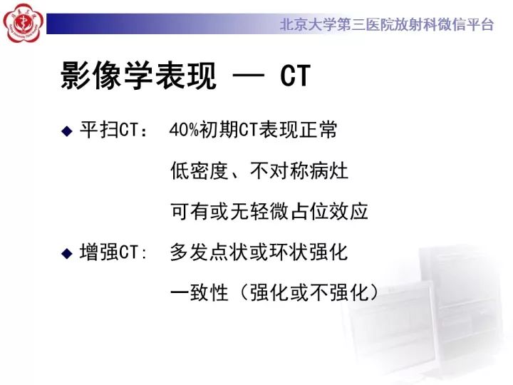【病例】急性播散型脑脊髓炎1例MR影像诊断
