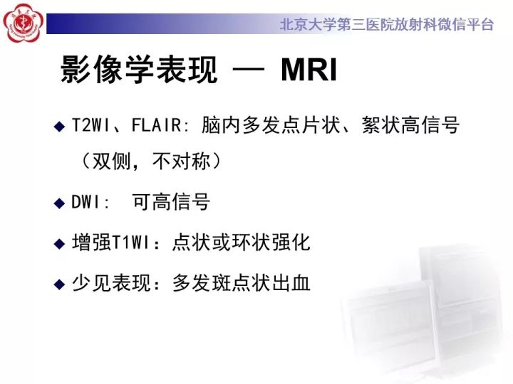 【病例】急性播散型脑脊髓炎1例MR影像诊断