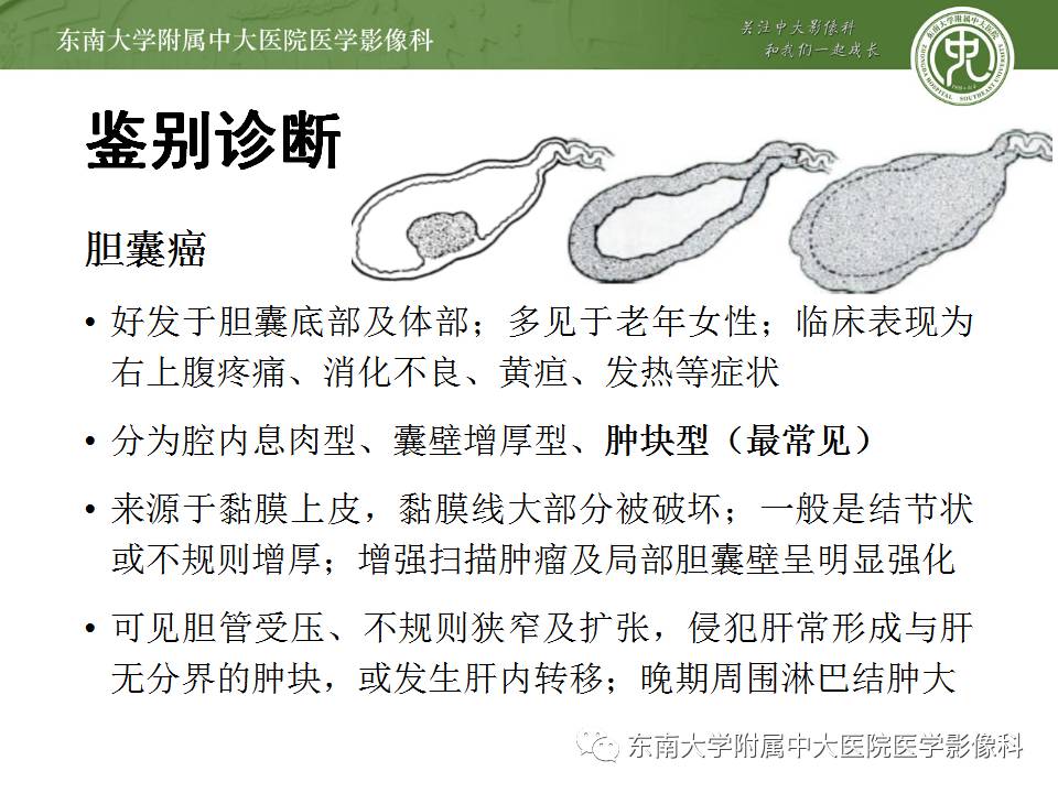【病例】胆囊腺肌症1例CT及MR影像表现