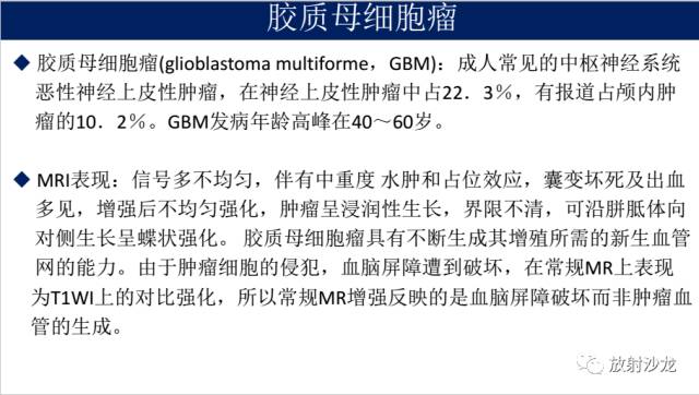 【病例】胶质母细胞瘤1例MR影像表现