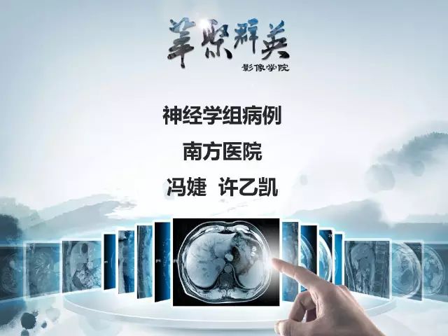 【病例】右额叶室管膜瘤伴团块状钙化1例CT及MR