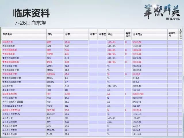 【病例】右额叶室管膜瘤伴团块状钙化1例CT及MR