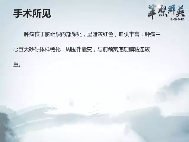 【病例】右额叶室管膜瘤伴团块状钙化1例CT及MR