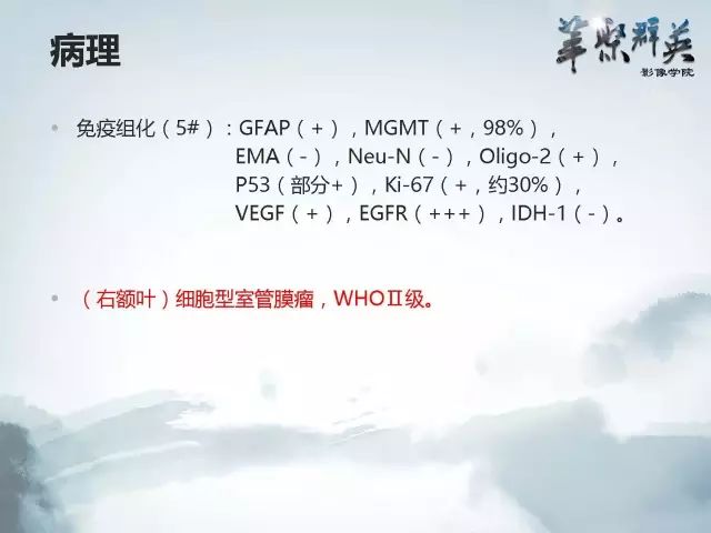 【病例】右额叶室管膜瘤伴团块状钙化1例CT及MR