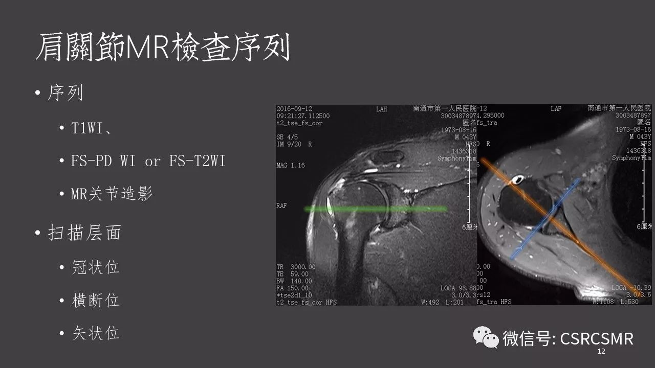 【PPT】肩关节MRI的结构式评估