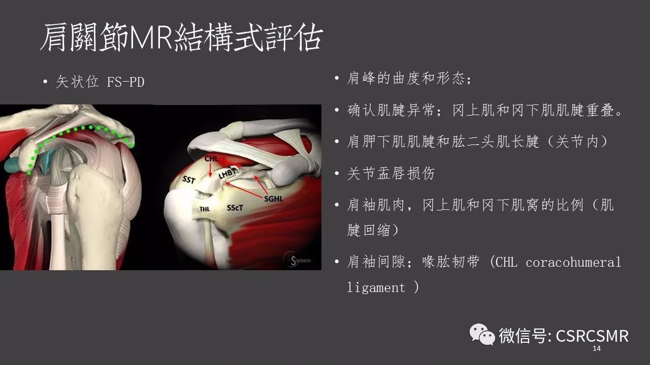 【PPT】肩关节MRI的结构式评估
