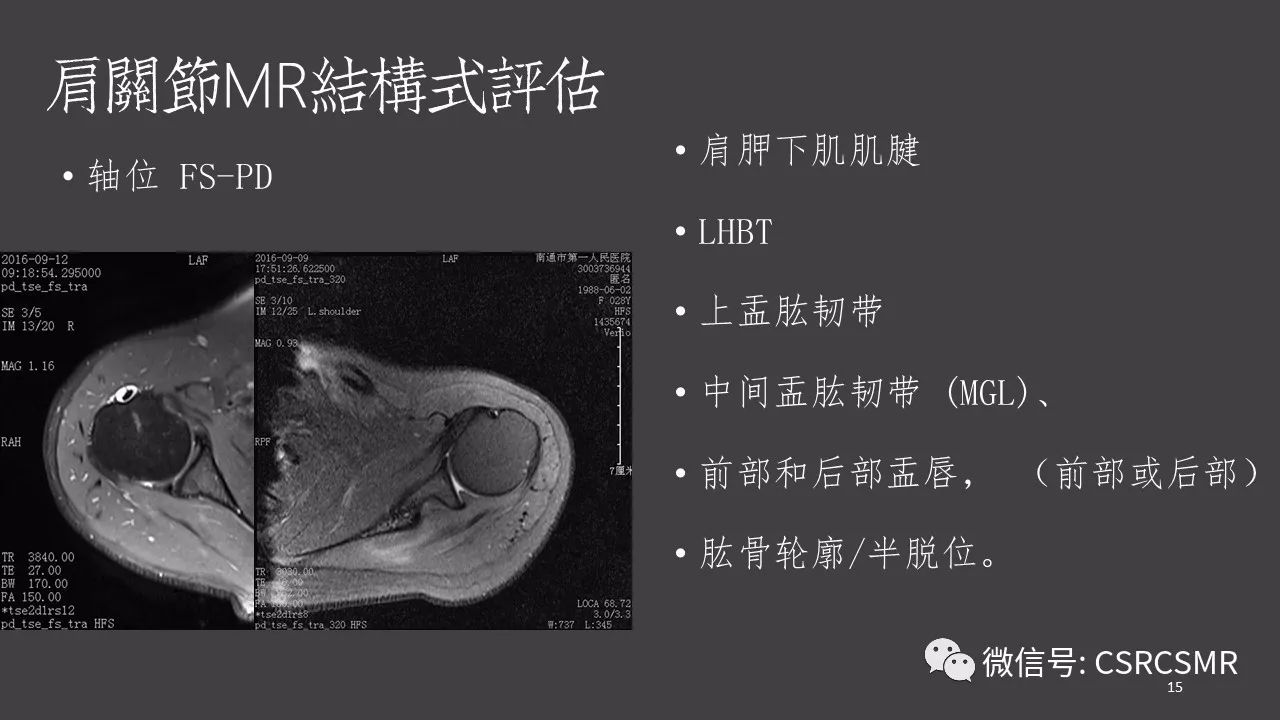 【PPT】肩关节MRI的结构式评估