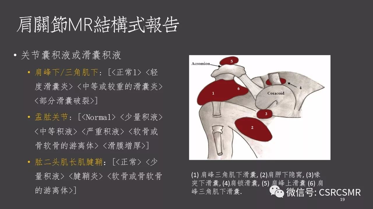 【PPT】肩关节MRI的结构式评估