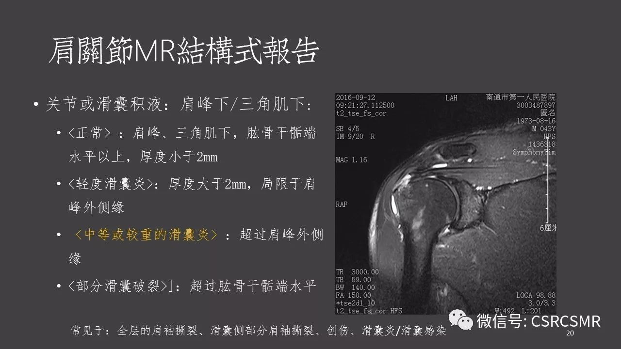 【PPT】肩关节MRI的结构式评估