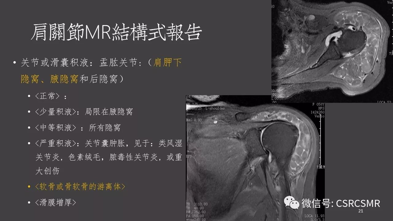 【PPT】肩关节MRI的结构式评估
