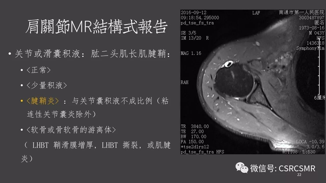 【PPT】肩关节MRI的结构式评估