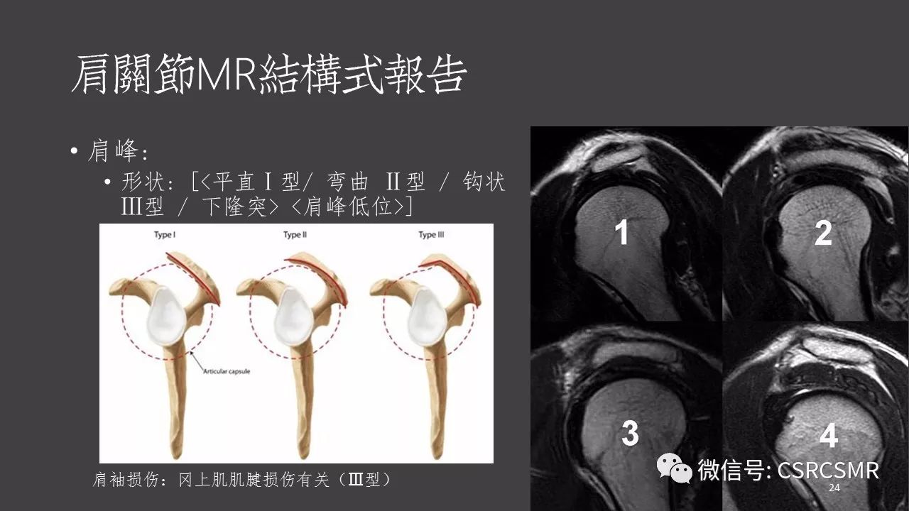 【PPT】肩关节MRI的结构式评估