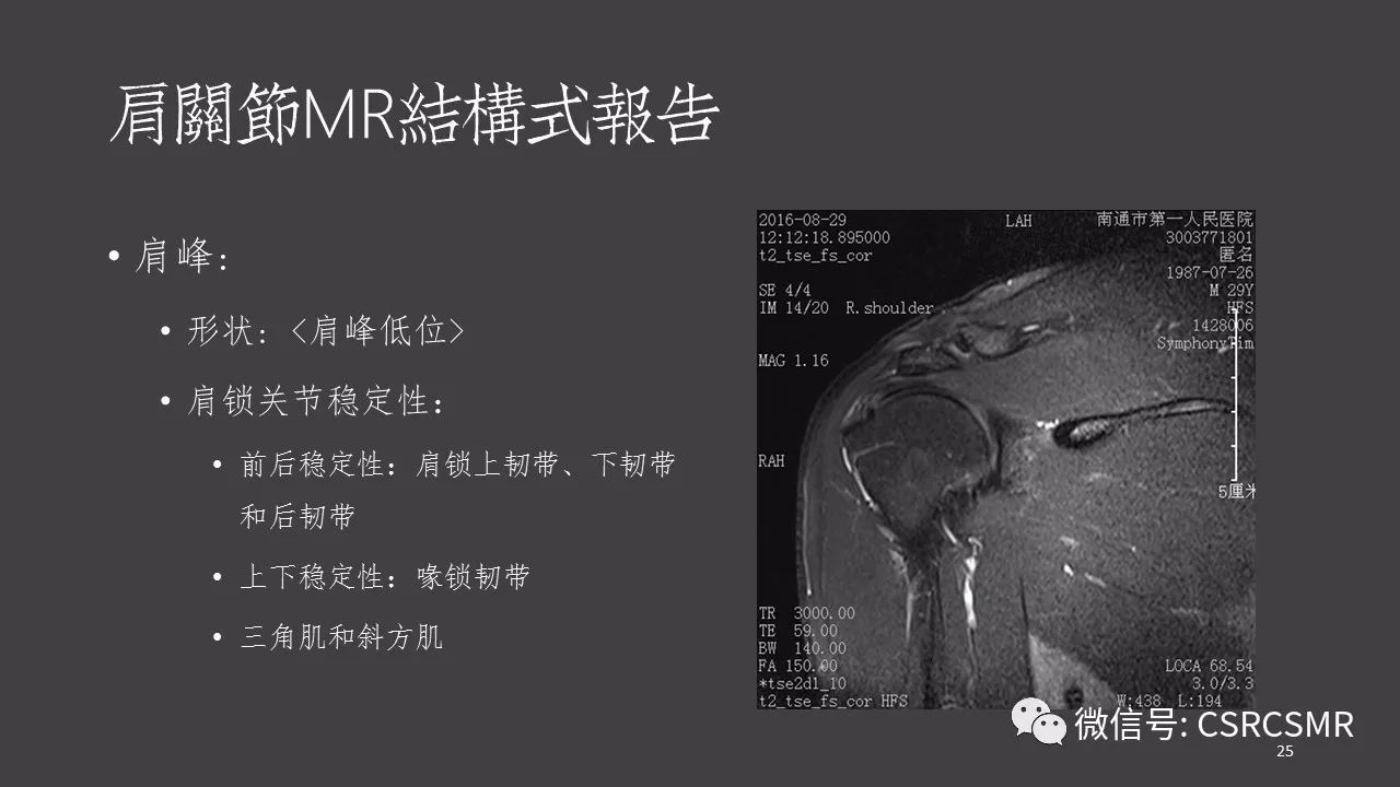 【PPT】肩关节MRI的结构式评估