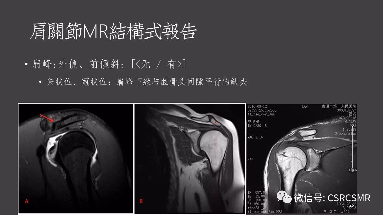 【PPT】肩关节MRI的结构式评估