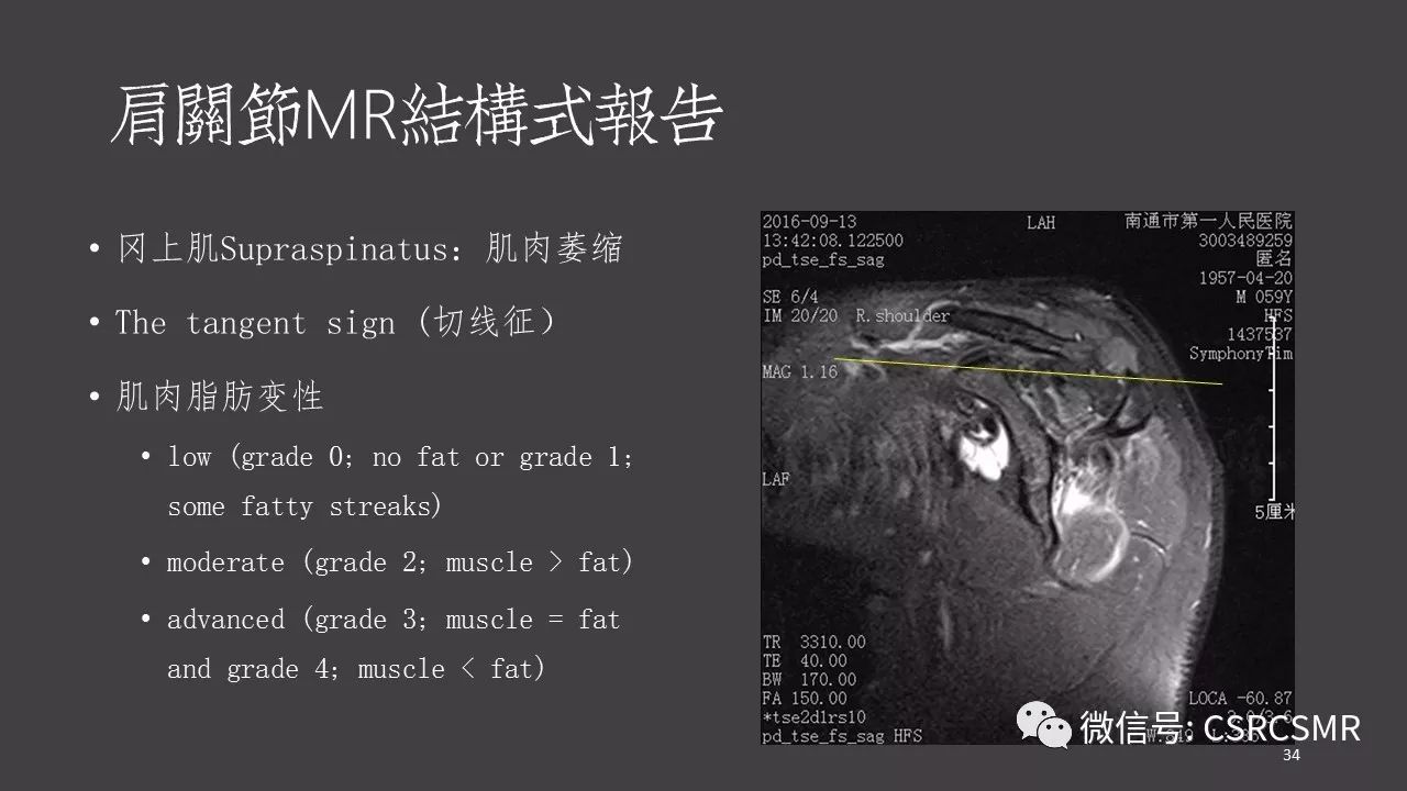 【PPT】肩关节MRI的结构式评估