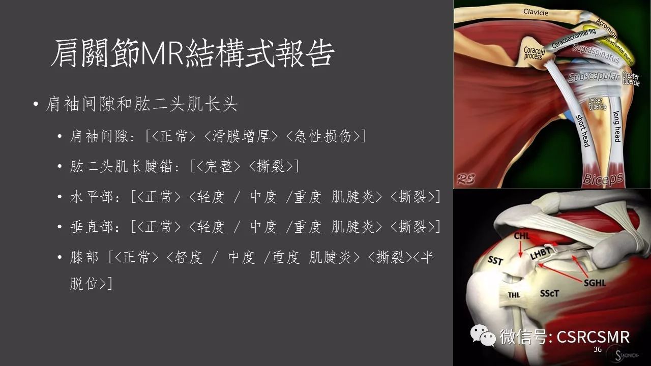 【PPT】肩关节MRI的结构式评估