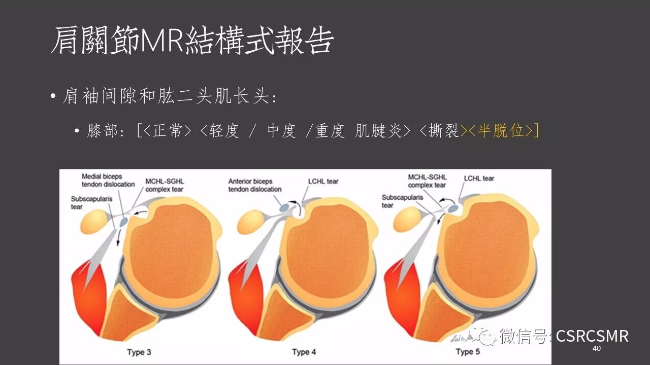 【PPT】肩关节MRI的结构式评估
