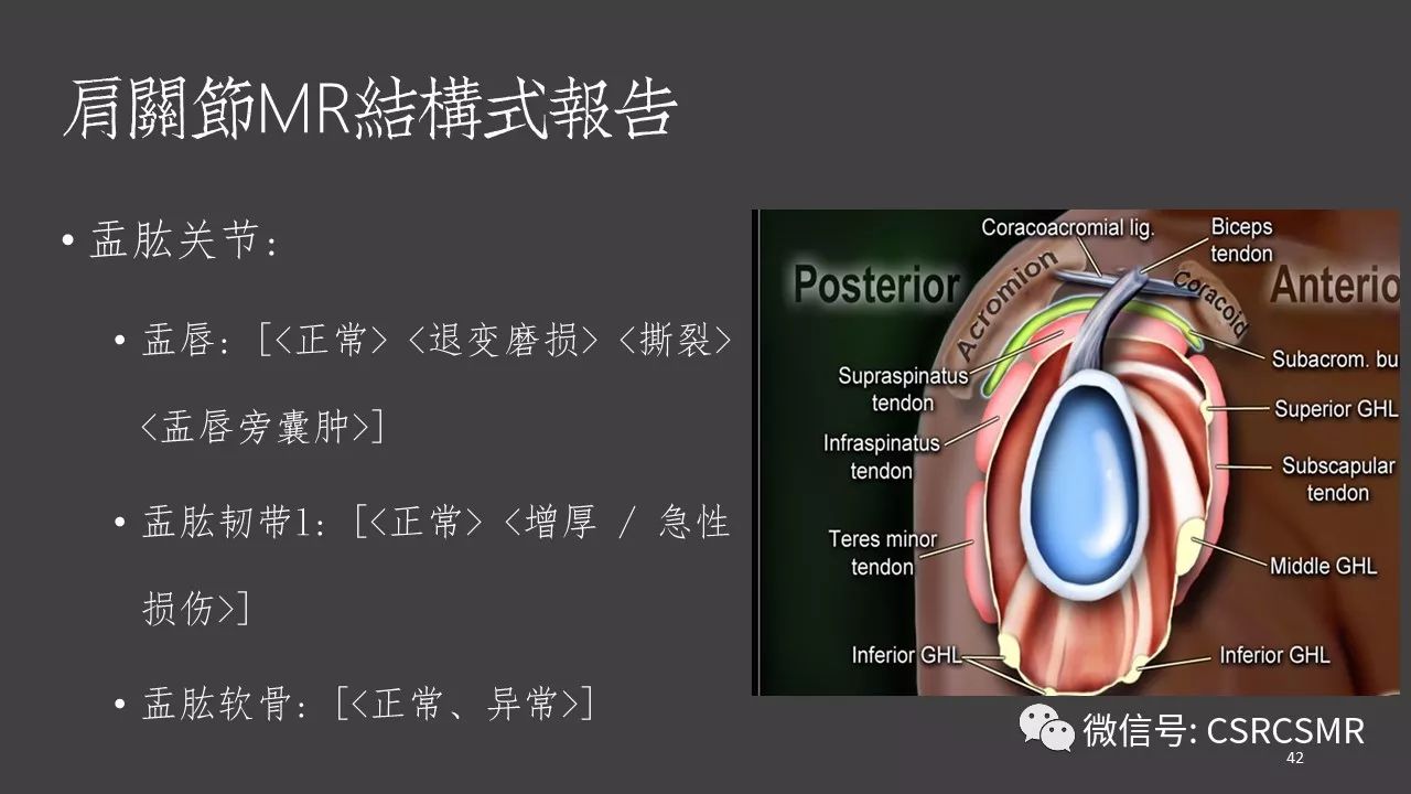 【PPT】肩关节MRI的结构式评估