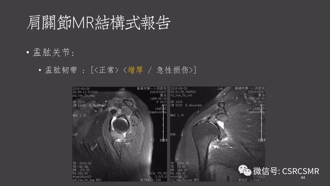 【PPT】肩关节MRI的结构式评估