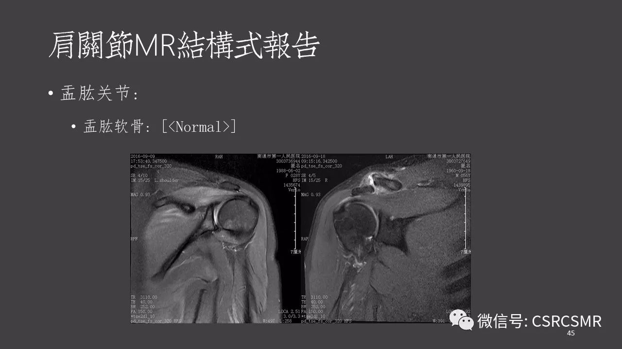【PPT】肩关节MRI的结构式评估