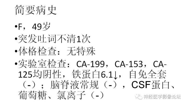 【病例】左额叶胶质母细胞瘤1例MR