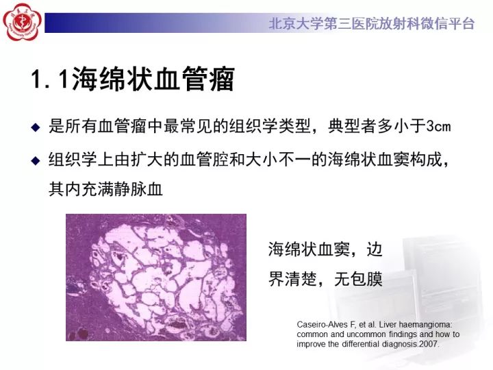 【PPT】肝脏血管源性肿瘤（一）