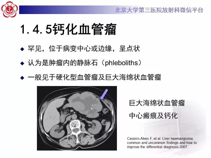 【PPT】肝脏血管源性肿瘤（一）