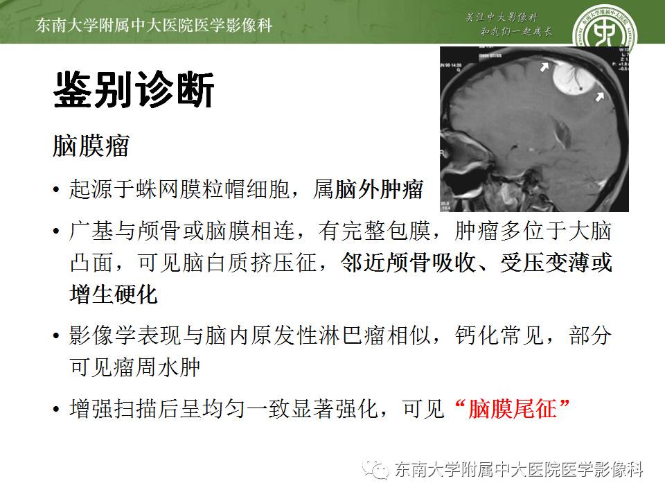 【病例】中枢神经系统淋巴瘤1例CT及MR影像诊断
