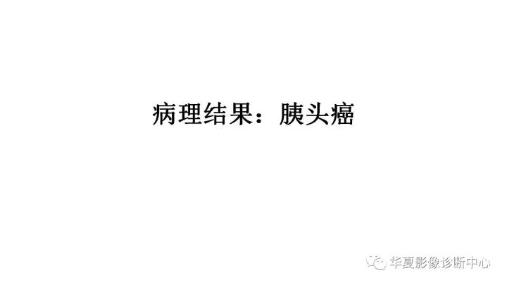 【病例】胰头癌1例CT影像表现