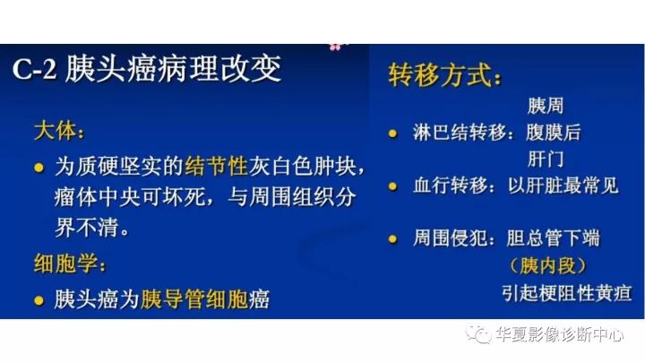 【病例】胰头癌1例CT影像表现