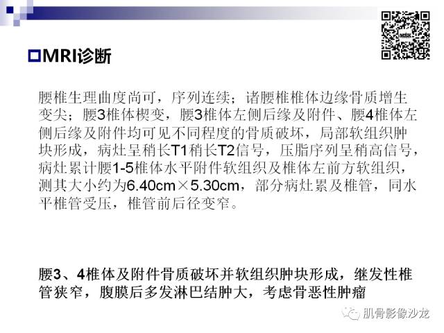 【病例】骨淋巴瘤5例影像讨论 【病例】骨淋巴瘤5例影像讨论