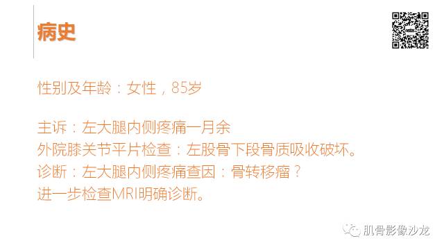 【病例】骨淋巴瘤5例影像讨论 【病例】骨淋巴瘤5例影像讨论