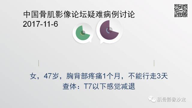 【病例】骨淋巴瘤5例影像讨论 【病例】骨淋巴瘤5例影像讨论